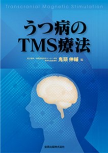 TMSはうつ病の新しい治療法です