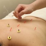 鍼灸はうつ病の抑うつの改善にも効果がある